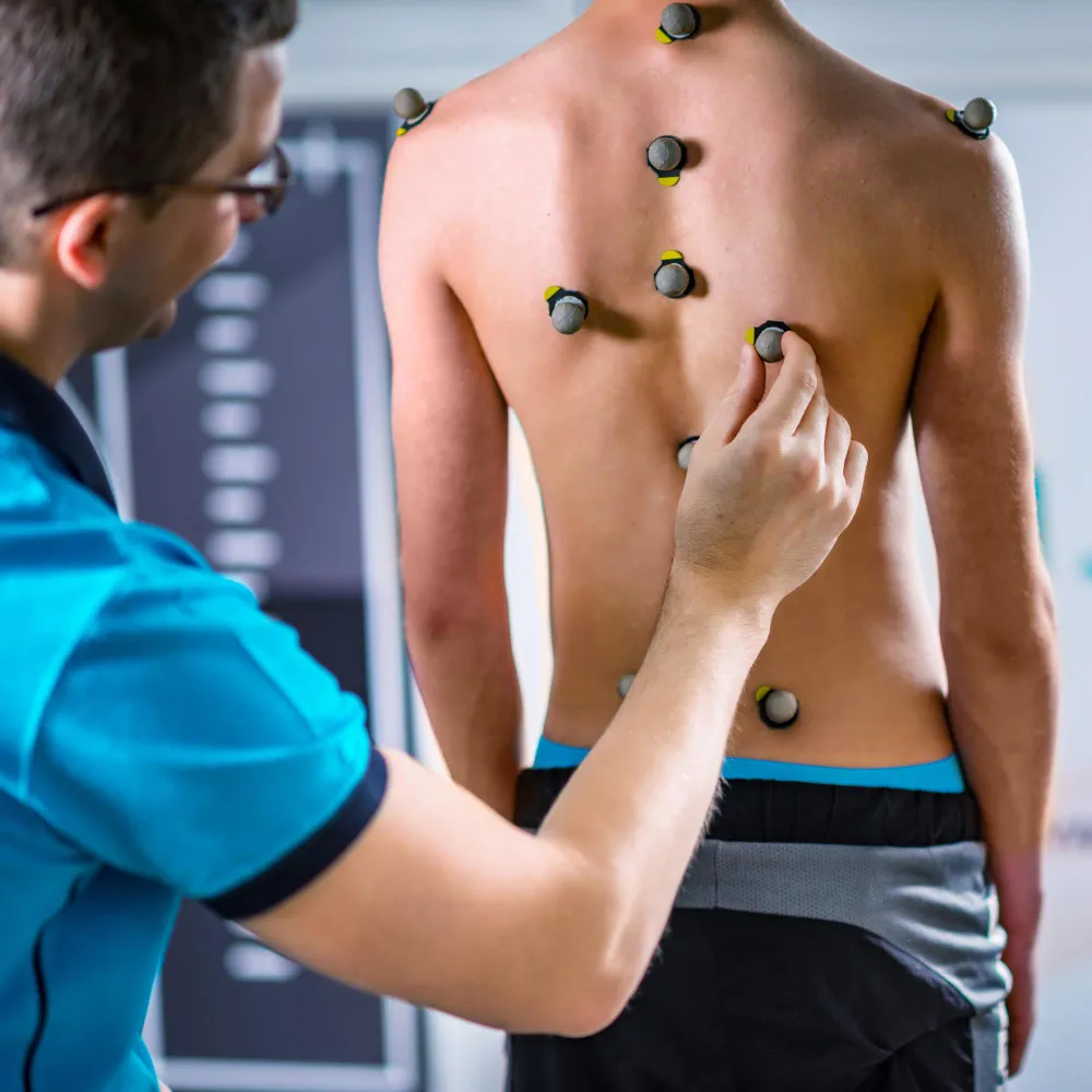 Dry Needling Therapy in Calgary